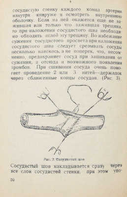 Крымов А.П. Огнестрельная аневризма. Челябинск: Медгиз Наркомздрава СССР, 1943.