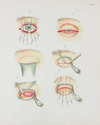 [Долганов В., автограф]. Долганов В. Атлас наиболее употребительных глазных операций с кратким их описанием. СПб., 1908.
