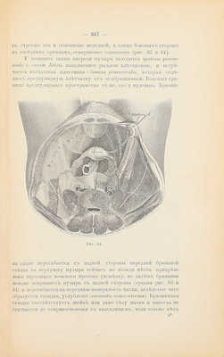 Руководство к хирургической анатомии. [В 2 ч.]. [Ч. 2: Таз, верхние и нижние конечности]. М.: Высочайше утвержденное т-во «Печатня С.П. Яковлева», 1893.